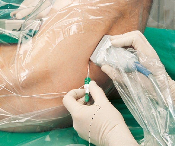 pain_therapy_orthopedic_and_trauma_surgery_teaser_600x500.jpg