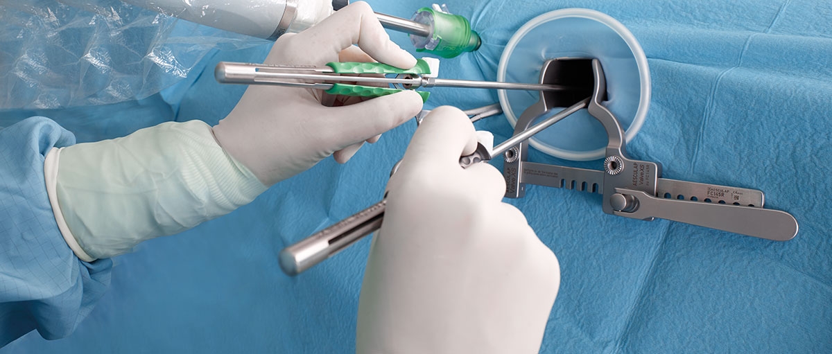 CardioThoracic Surgery